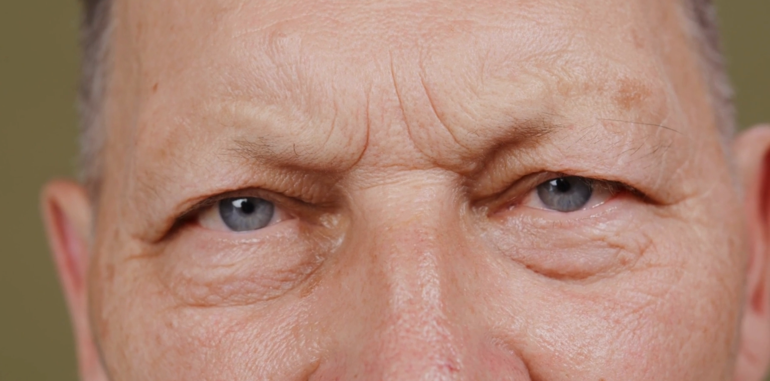 Using AI Technology to Increase Access to Eye Care in Rural Maine